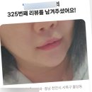 졸리멍 | 천안 불당동 피부과 입술필러 내돈내산 솔직후기