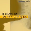 허리디스크가 터지는 진짜 이유는? 이미지