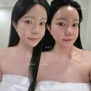 키안에스테틱 | 의정부 피부관리 비움에스테틱 신부관리 후기, 수분부족 예민피부 케어받고 온 날