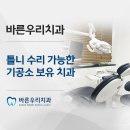 우리치아 치과기공소 이미지