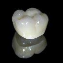 튼튼치과기공소 이미지