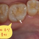 동탄키움치과의원 이미지