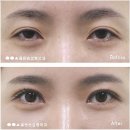 옳은손성형외과