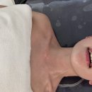 범어목련아파트 상가 앞 | 수성구피부관리 영에스테틱 범어점, 윤곽관리 솔직후기+전후비교
