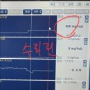 10년타기정비센타 | 기아 스포티지 매연 검사 불합격, 자동차 검사 불합격 카윈스 10년타기정비센터