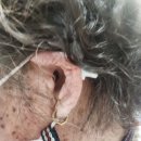 엘에스메디칼 | 세종보청기 “소리는 충분했는데 대화가 어려웠습니다” 1933년생 어머님 후기