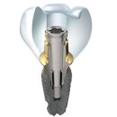 ㈜진덴탈 이미지