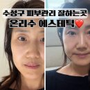 온리수야 | 수성구 피부관리 잘하는 온리수 에스테틱 수성동 팔자주름 효과본 후기