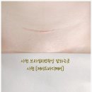 사천성모의원 네이버블로그