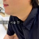 모드이벤트 | 대구피부과 인모드 후기 동성로인모드 리프팅 효과 리얼 후기
