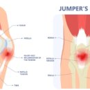백세마취통증의학과의원 이미지