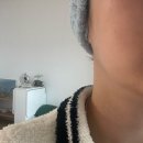 세븐일레븐대구지봉초점 | (대봉동피부관리) 솔에스테틱 여드름관리 솔직 후기