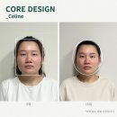 청담코어디자인헬리오스지점 | 큰 두상도 작아질 수 있을까요?(두산 호흡으로 체인지)