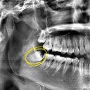 요셉마인드치과의원 이미지
