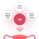 이화산부인과 네이버블로그