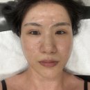 광교 에스테틱 루비엔에스테틱 진정필관리 솔직리뷰