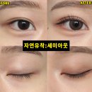 세미성형외과의원 이미지