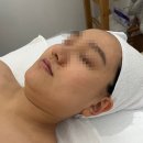 청천동피부관리::아느크 에스테틱에서 하이푸리프팅x물방울초음파 관리받은 후기