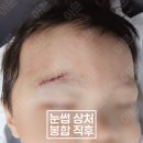 아기눈썹