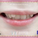 원진치과기공소 이미지