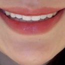 슈어란트치과의원 이미지