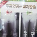 천안본정형외과 무릎통증 허리통증 효과적치료 이미지