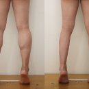 아름다운 여성의원 | 제대로 된 종아리알주사 가격후기효과 무엇이 제일 궁금하니? - 세이지의원 칼럼