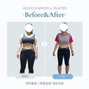 뉴로트레이닝센터 이미지