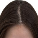 예나르 | 부산탈모관리 가르마헤어라인 동래 예나르SMP 후기