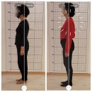 올인필라테스피티 | 삼성동 필라테스 피티 고관절 인공관절 수술 후 재활운동 20회 후기 비포 애프터