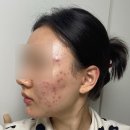 GS25 구지디에트르점 | 송도 비담에스테틱 후기(+피부 관리에 돈 좀 써 본 사람의 솔직 리뷰)