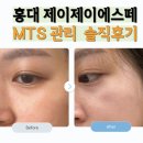 제이제이메디칼 | 홍대에스테틱 추천, MTS로 홍조와 피부 고민 끝! 제이제이에스떼