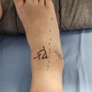 대동의원 | MBO 수술 후기 (2) 입원 준비~수술~퇴원 : 보호자 없이 입원, 입원 준비물, 수술 통증, 자세한 후기