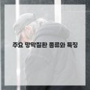 서초 바른빛안과의원 네이버블로그