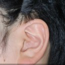 비아이오성형외과의원 이미지