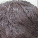 유피성형외과의원 | 부산탈모 유피성형외과 후기