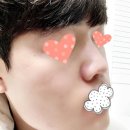 컴플렉스케어 네이버블로그