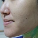 케이(K)-썸