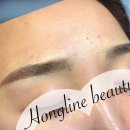 홍 헤어라인 이미지