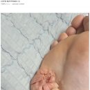 혐주의)티눈갤 레전드 유저 이미지