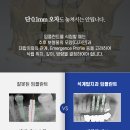 석계고운이치과의원 | 석계역치과 의심가는 증상이 있다면