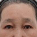 고유성형외과의원 네이버블로그