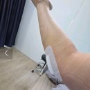 골프효자손마취통증의학과의원 | 테넥스 시술 후기: 양팔 테니스·골프 엘보 치료기