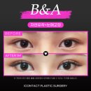 아이컨텍성형외과의원 이미지