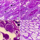 흰다리새우의 Necrotizing hepatopabacterium(NHPB) 이미지