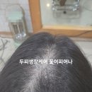 도남주유소 | 제주여성 두피생장 케어 정수리·가르마 숱 회복, 꾸준히 하면 정말 달라질까?