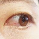 삼성밝은의원 이미지