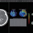 제이엘케이 이미지