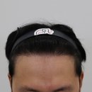 압구정맘모스헤어라인의원 이미지