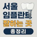 튼튼플란트치과의원 | 서울 임플란트 치과 잘하는 곳 가격 비용 견적 (2025년 총정리)